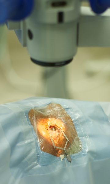 Eye Surgery | ROQUE Eye Clinic | Eye.com.ph