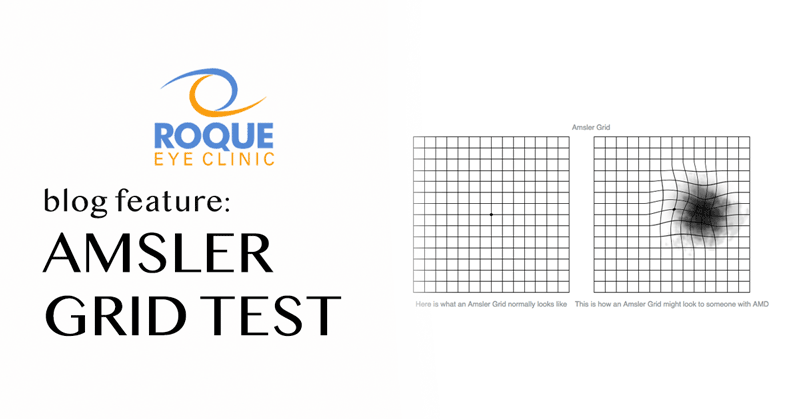 Amsler Grid Test  Roque Eye Clinic