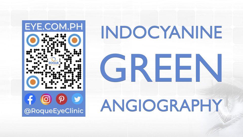 REC QR 2021 16x9 Indocyanine Green Angiography