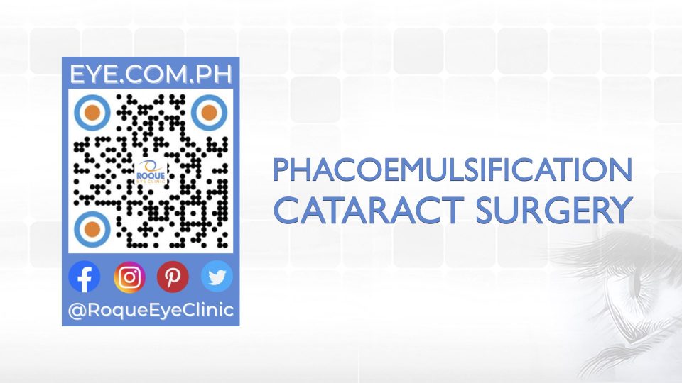 REC QR 2021 16x9 Phacoemulsification Cataract Surgery