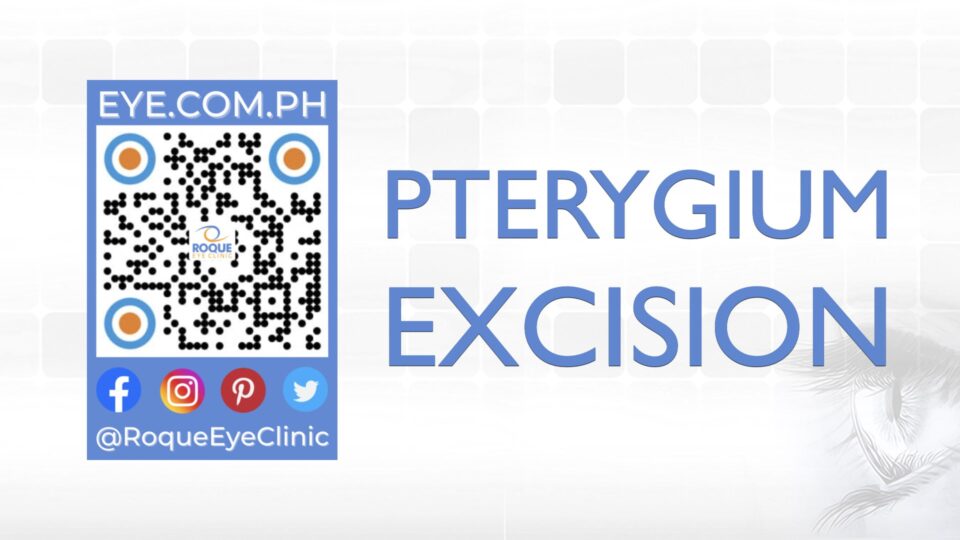 REC QR 2021 16x9 Pterygium Excision