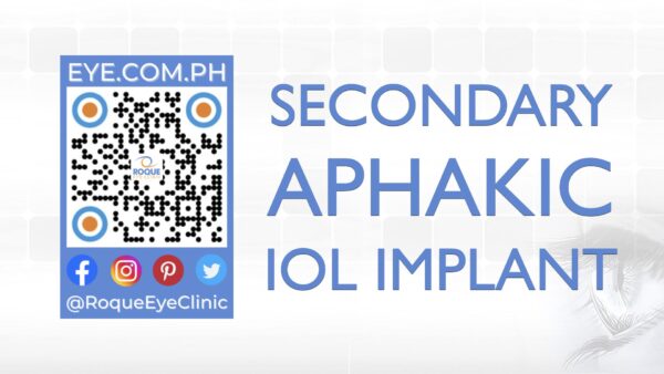 REC QR 2021 16x9 Secondary Aphakic IOL Implant