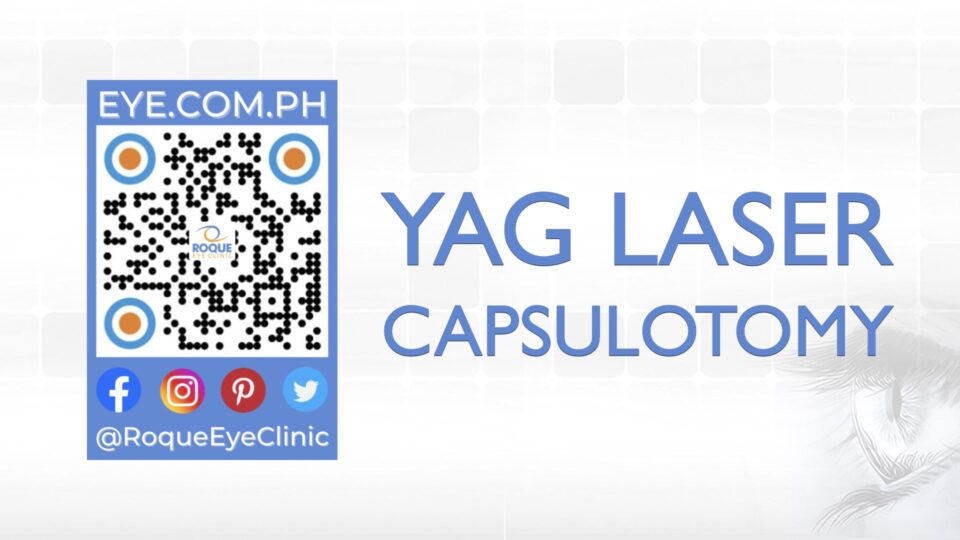 REC QR 2021 16x9 YAG Laser Capsulotomy