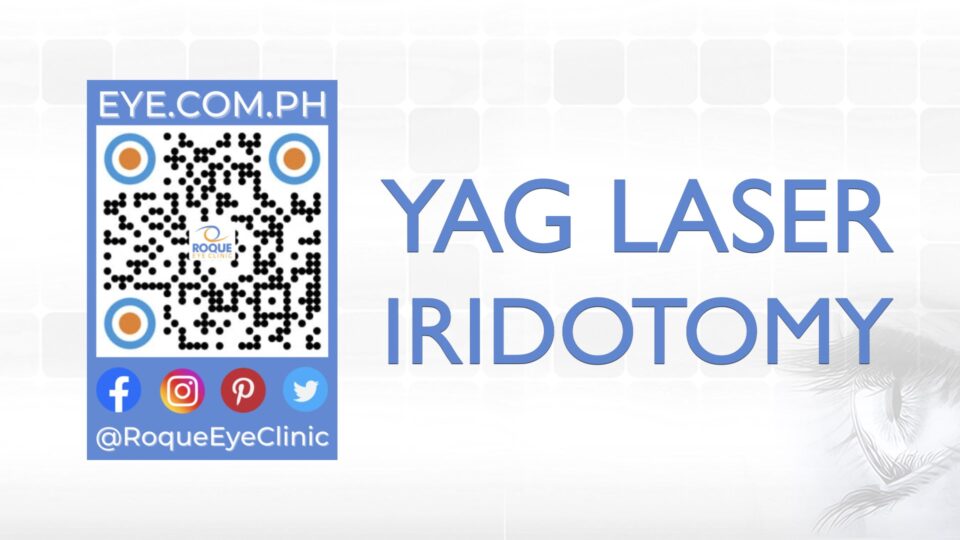 REC QR 2021 16x9 YAG Laser Iridotomy