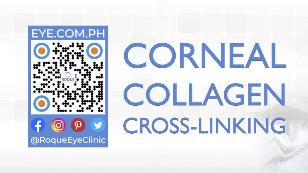 REC QR 2021 16x9 Corneal Collagen Cross-Linking