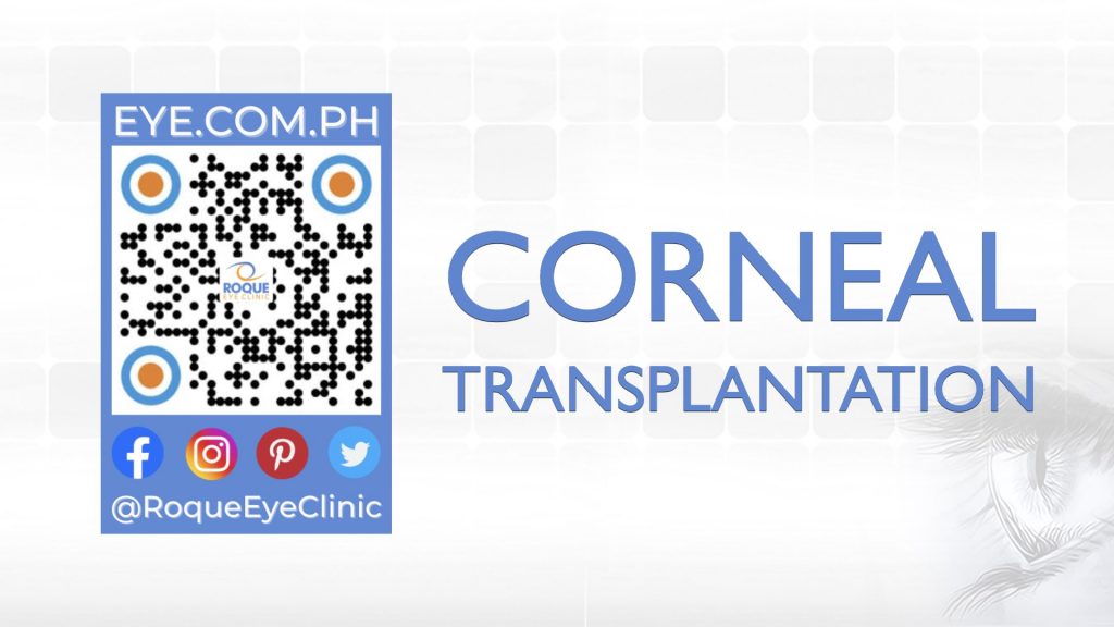 REC QR 2021 16x9 Corneal Transplantation