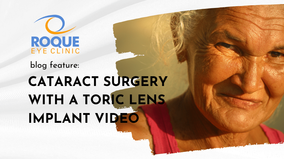 Cataract Surgery with a Toric Lens Implant Video ROQUE Eye Clinic