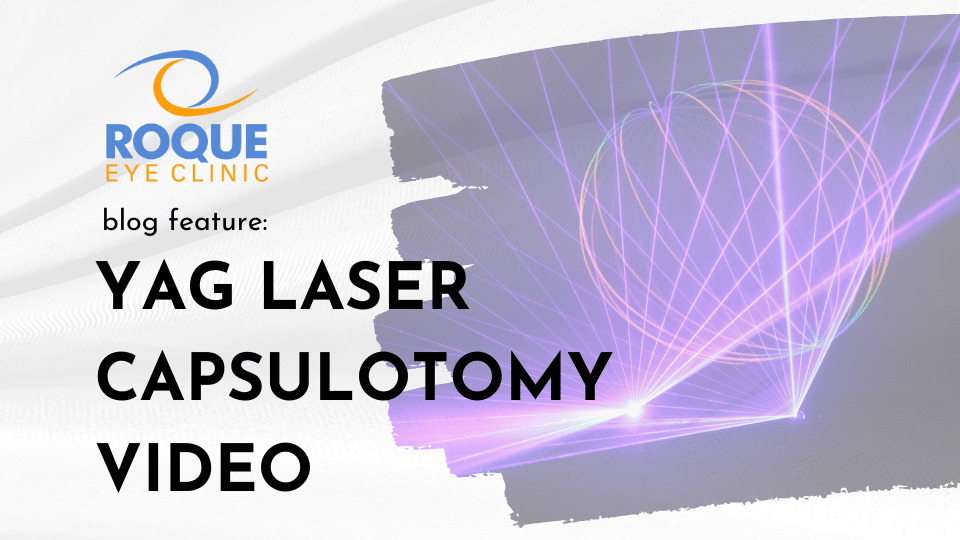YAG Laser Capsulotomy Video ROQUE Eye Clinic