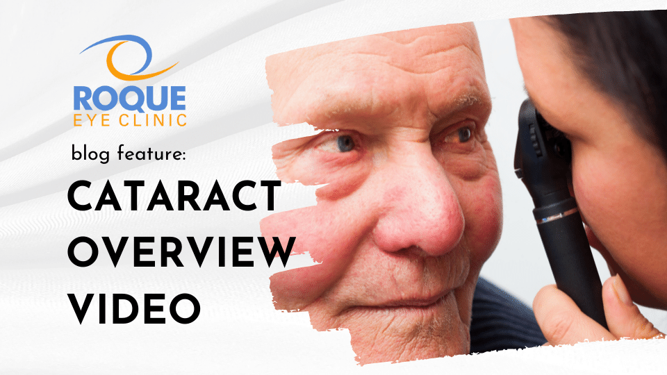 Cataract Overview Video ROQUE Eye Clinic
