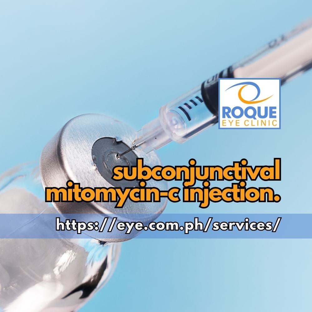 Subconjunctival Mitomycin Injection ROQUE Eye Clinic